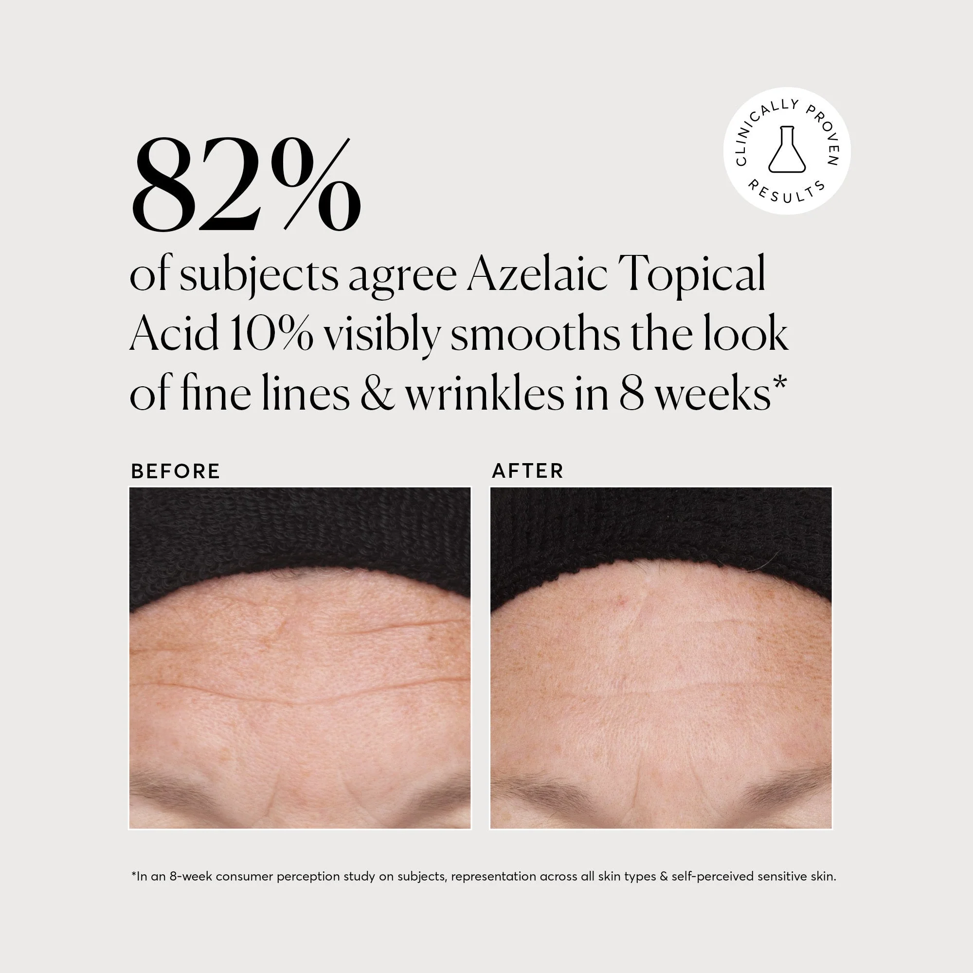 Azelaic Topical Acid 10% - Image 5