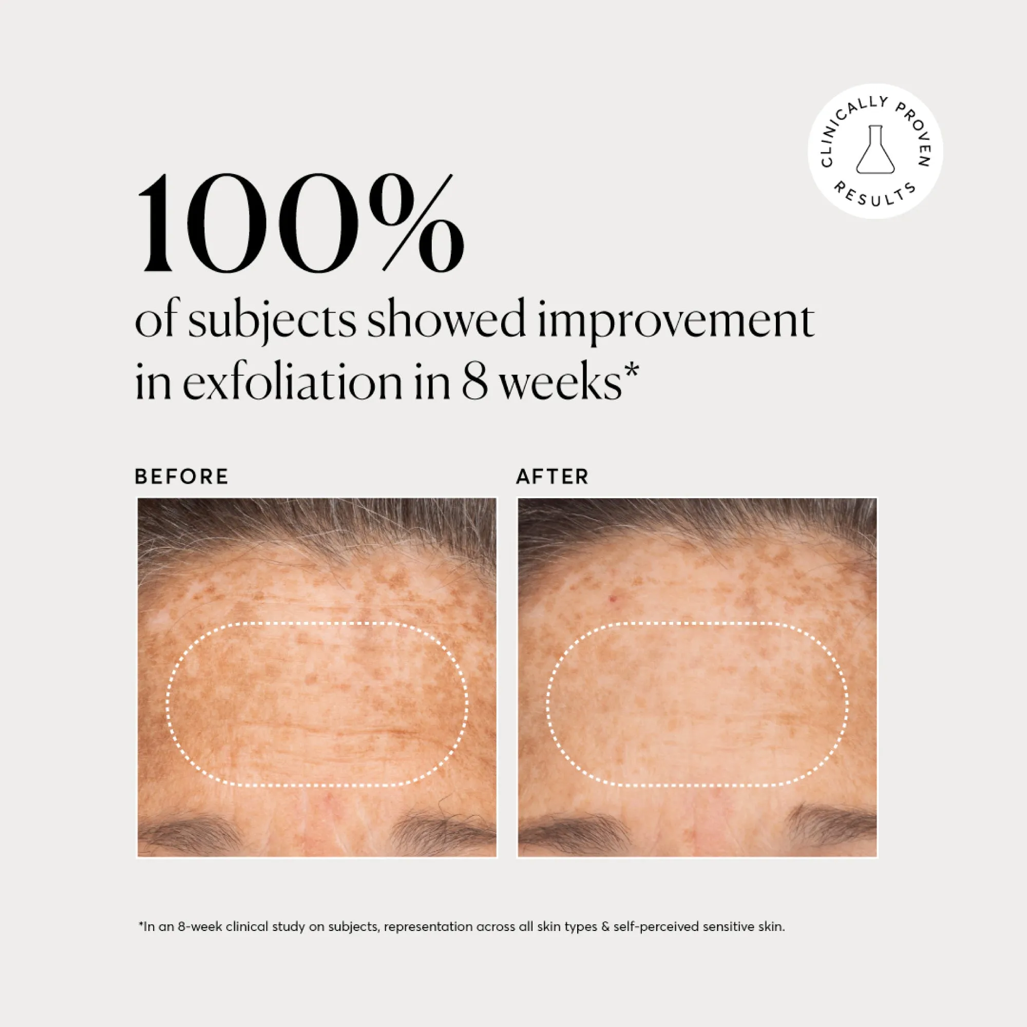 BHA Liquid Exfoliant 2% - Image 4