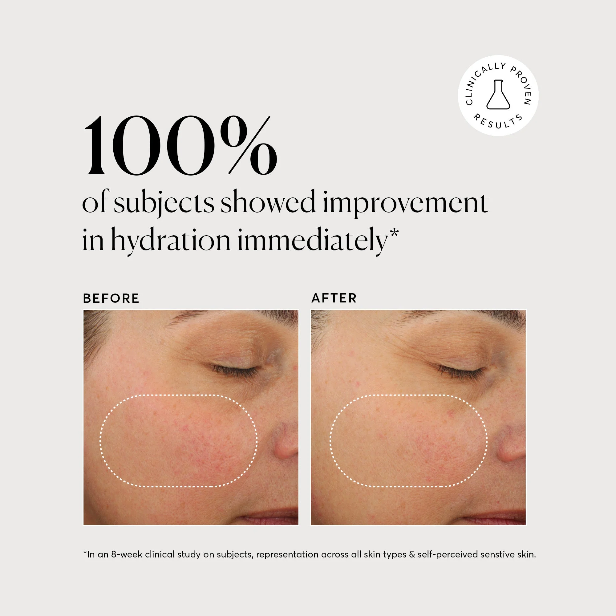 Plant Ceramide Rich Moisture Cream - Image 5